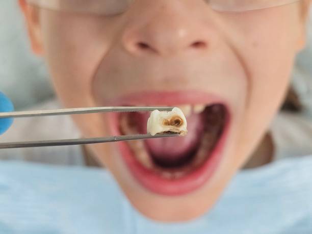 Best Emergency Treatment for Toothache in Valdosta, GA